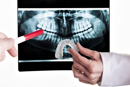 Radiologia Digitale