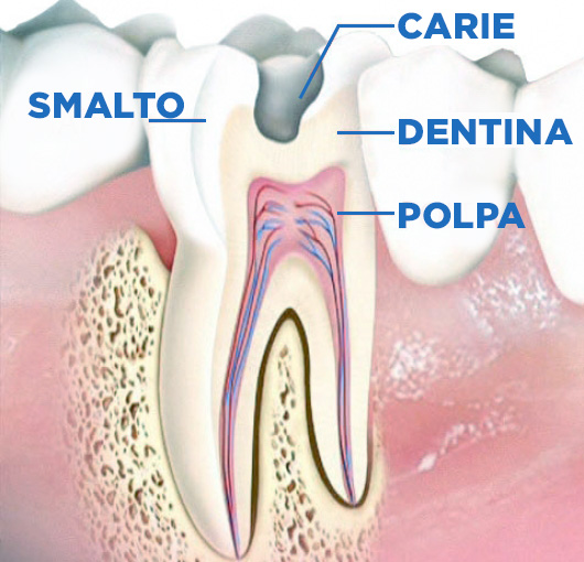 Endodonzia